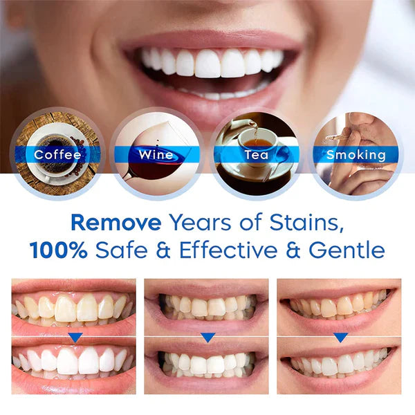 FlashWhite –Teeth Whitening Essence (DENT BLANCHE)